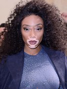 Winnie Harlow nude 18